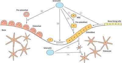 Sclerostin as a biomarker of physical exercise in osteoporosis: A narrative review